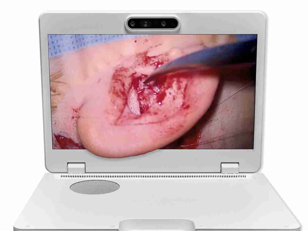 达擎之＂Heads-up 3D显微手术显示系统＂，，，，整合4K裸眼3D显示及眼球追踪系统，，具备快速追踪人眼移动位置功能，，，，减轻医师长时间维持固定姿势的负担，，，，让医师能有更宽广清晰的3D立体视野及更舒适的姿势来执行手术。。。